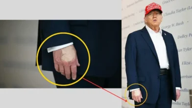 Donald Trump Health News : खुला हाथ पर मेकअप का चौकाने वाला राज़